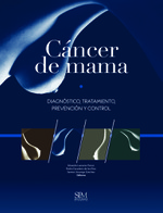 Cáncer de mama. Diagnóstico, tratamiento, prevención y control